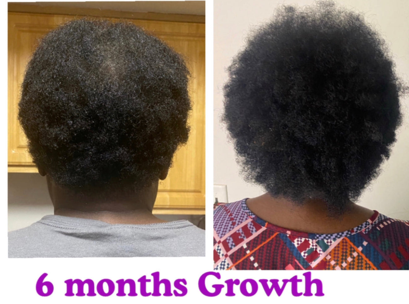 Herbal Leave in & Hair Growth Oil SET