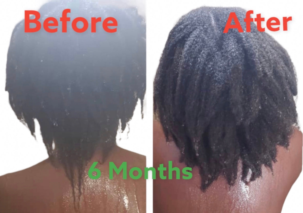 Absolute Hair Growth oil 4 oz (100ml)
